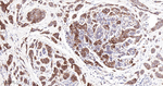 CD104 Antibody in Immunohistochemistry (Paraffin) (IHC (P))
