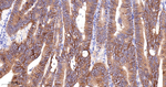 CD104 Antibody in Immunohistochemistry (Paraffin) (IHC (P))