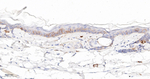 CD104 Antibody in Immunohistochemistry (Paraffin) (IHC (P))