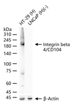 CD104 Antibody in Western Blot (WB)