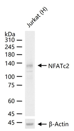 NFATC2 Recombinant Rabbit Monoclonal Antibody (9A11)