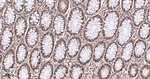 BID Antibody in Immunohistochemistry (Paraffin) (IHC (P))