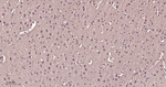 VCP Antibody in Immunohistochemistry (Paraffin) (IHC (P))