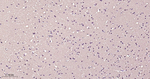 VCP Antibody in Immunohistochemistry (Paraffin) (IHC (P))