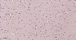 VCP Antibody in Immunohistochemistry (Paraffin) (IHC (P))