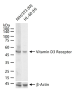 VDR Recombinant Rabbit Monoclonal Antibody (14E4)