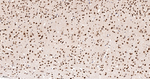 PRMT1 Antibody in Immunohistochemistry (Paraffin) (IHC (P))