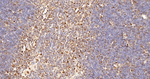 PRMT1 Antibody in Immunohistochemistry (Paraffin) (IHC (P))