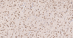 PRMT1 Antibody in Immunohistochemistry (Paraffin) (IHC (P))