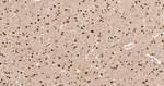 PRMT1 Antibody in Immunohistochemistry (Paraffin) (IHC (P))