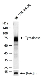 Tyrosinase Antibody in Western Blot (WB)