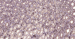 GRP94 Antibody in Immunohistochemistry (Paraffin) (IHC (P))