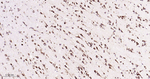 GRP94 Antibody in Immunohistochemistry (Paraffin) (IHC (P))