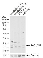 RAC1/RAC2/RAC3 Antibody in Western Blot (WB)