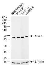 AXIN2 Recombinant Rabbit Monoclonal Antibody (4G17)