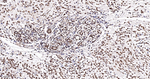 Ku70 Antibody in Immunohistochemistry (Paraffin) (IHC (P))