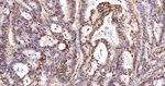 Ku70 Antibody in Immunohistochemistry (Paraffin) (IHC (P))