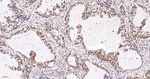 Ku70 Antibody in Immunohistochemistry (Paraffin) (IHC (P))