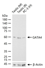 GATA4 Antibody in Western Blot (WB)
