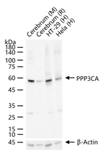 Calcineurin A Recombinant Rabbit Monoclonal Antibody (12D3)