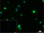 XRCC1 Recombinant Rabbit Monoclonal Antibody (5C16)