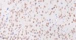 FMRP Antibody in Immunohistochemistry (Paraffin) (IHC (P))