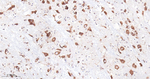 FMRP Antibody in Immunohistochemistry (Paraffin) (IHC (P))