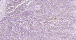 MUC5AC Antibody in Immunohistochemistry (Paraffin) (IHC (P))