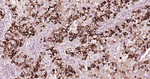 MUC5AC Antibody in Immunohistochemistry (Paraffin) (IHC (P))