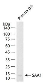 SAA Antibody in Western Blot (WB)