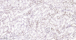53BP1 Antibody in Immunohistochemistry (Paraffin) (IHC (P))