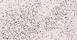 53BP1 Antibody in Immunohistochemistry (Paraffin) (IHC (P))