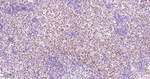 53BP1 Antibody in Immunohistochemistry (Paraffin) (IHC (P))