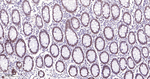 53BP1 Antibody in Immunohistochemistry (Paraffin) (IHC (P))