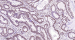 53BP1 Antibody in Immunohistochemistry (Paraffin) (IHC (P))