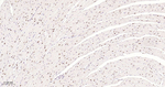 53BP1 Antibody in Immunohistochemistry (Paraffin) (IHC (P))
