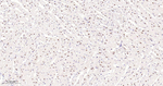 53BP1 Antibody in Immunohistochemistry (Paraffin) (IHC (P))