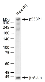53BP1 Antibody in Western Blot (WB)