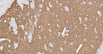PRKAR2B Antibody in Immunohistochemistry (Paraffin) (IHC (P))