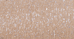 PRKAR2B Antibody in Immunohistochemistry (Paraffin) (IHC (P))