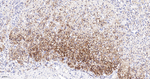 PRKAR2B Antibody in Immunohistochemistry (Paraffin) (IHC (P))