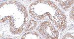 PRKAR2B Antibody in Immunohistochemistry (Paraffin) (IHC (P))