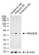 PRKAR2B Antibody in Western Blot (WB)