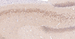 SOS1 Antibody in Immunohistochemistry (Paraffin) (IHC (P))