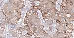 SOS1 Antibody in Immunohistochemistry (Paraffin) (IHC (P))