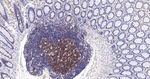 SOS1 Antibody in Immunohistochemistry (Paraffin) (IHC (P))