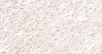CaMKII delta Antibody in Immunohistochemistry (Paraffin) (IHC (P))