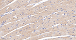 CaMKII delta Antibody in Immunohistochemistry (Paraffin) (IHC (P))
