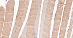 CaMKII delta Recombinant Rabbit Monoclonal Antibody (1A5)