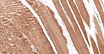 CaMKII delta Antibody in Immunohistochemistry (Paraffin) (IHC (P))